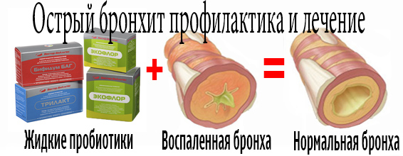 Острый бронхит профилактика и лечение
